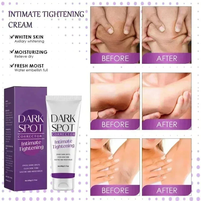 Nicotinamide Brightening Cream For Dark Skin Effective Lighten Thigh Inner Bleach Remove Melanin Private Parts Brighten Cream