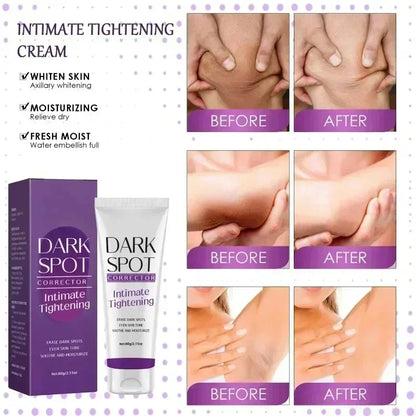 Nicotinamide Brightening Cream For Dark Skin Effective Lighten Thigh Inner Bleach Remove Melanin Private Parts Brighten Cream