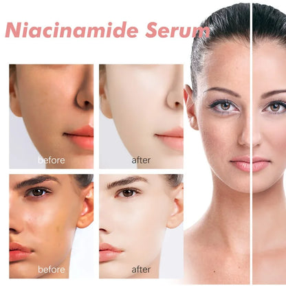 Peach Niacinamide Essence Women Moisturize Brighten Face Serum