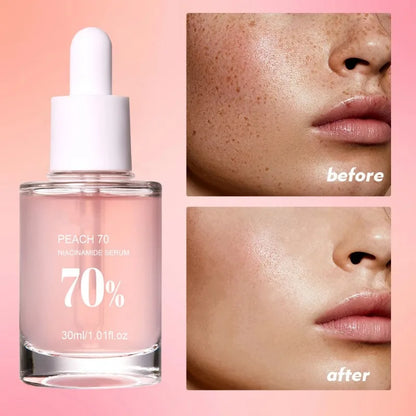 Peach Niacinamide Essence Women Moisturize Brighten Face Serum