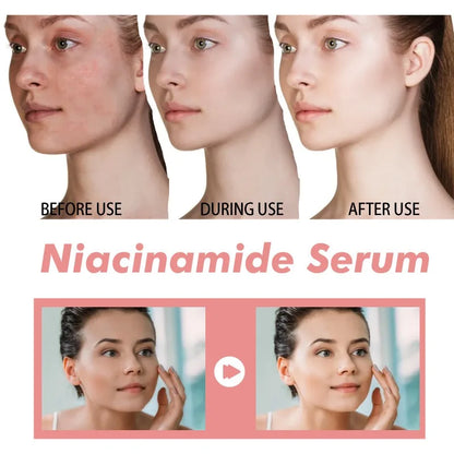 Peach Niacinamide Essence Women Moisturize Brighten Face Serum