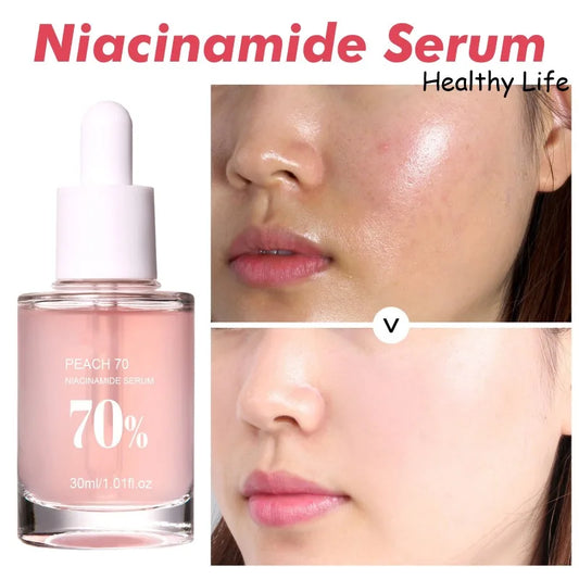 Peach Niacinamide Essence Women Moisturize Brighten Face Serum